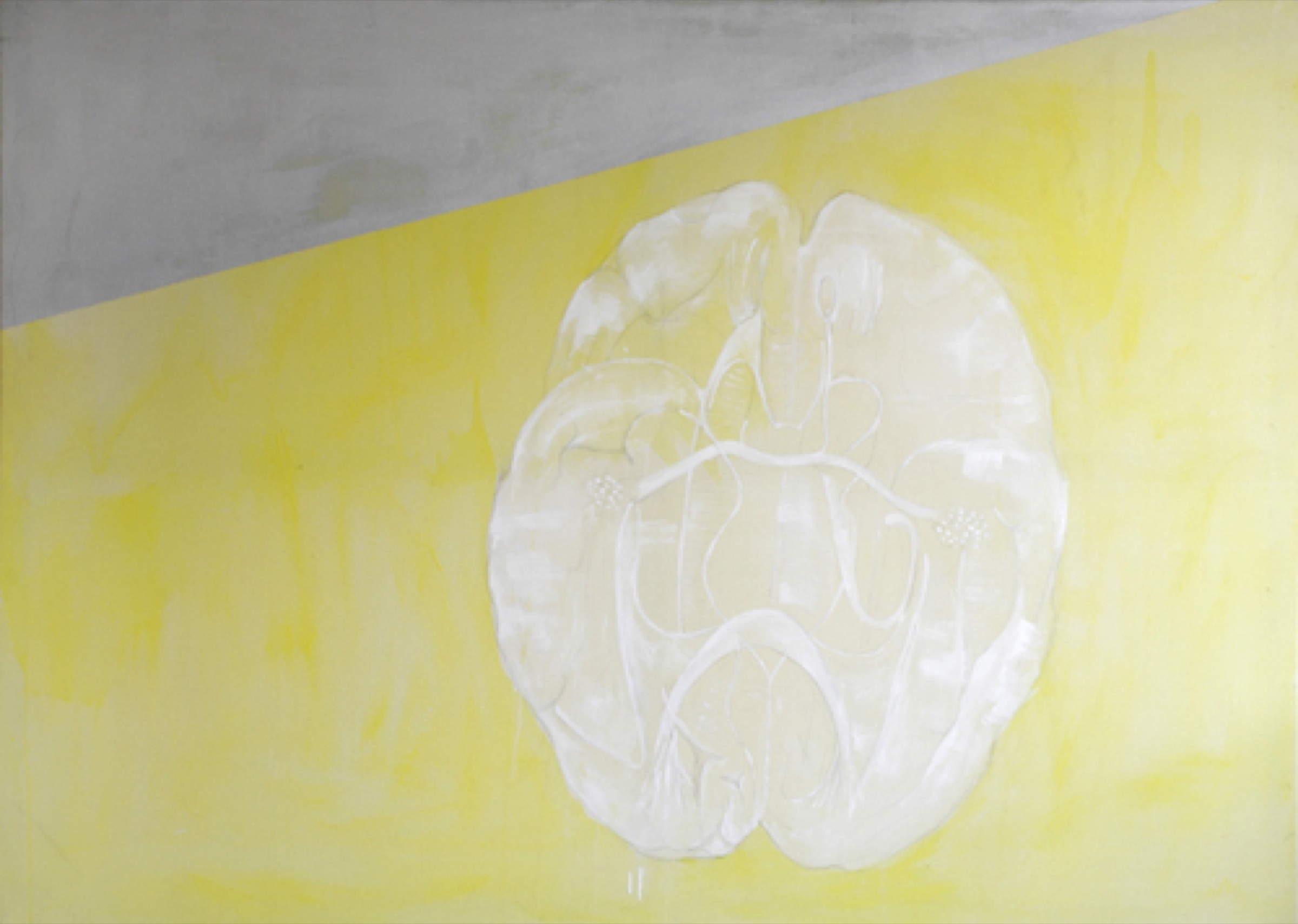 Central Nervous System 1997